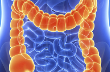 Irritable Bowel Syndrome