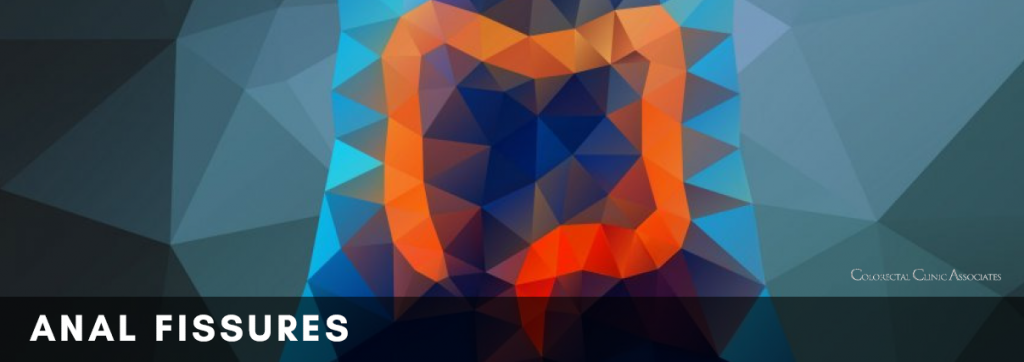 Anal Fissure