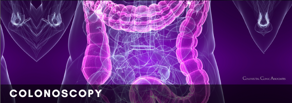 Colonoscopy