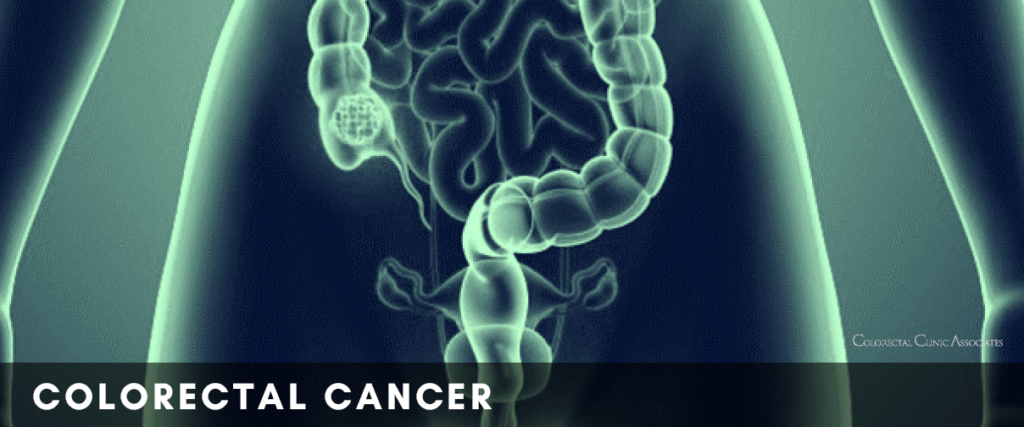 Colorectal Cancer