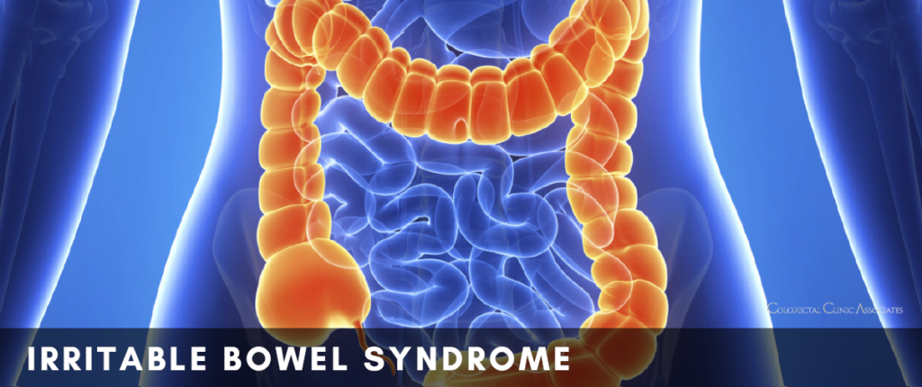 Irritable Bowel Syndrome