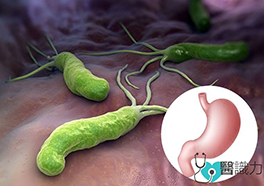Helicobacter pylori