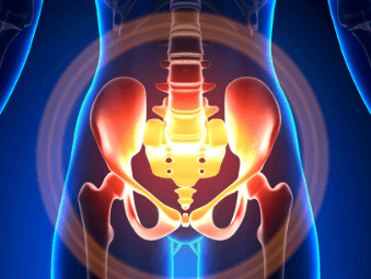 Pelvic Floor Disorders