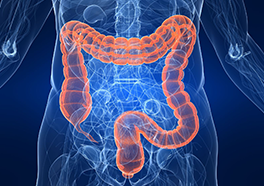Colorectal Cancer